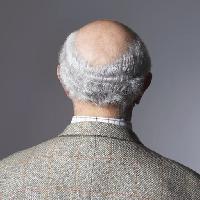 skaldet, mand, ryg, hoved, hår Photographerlondon
